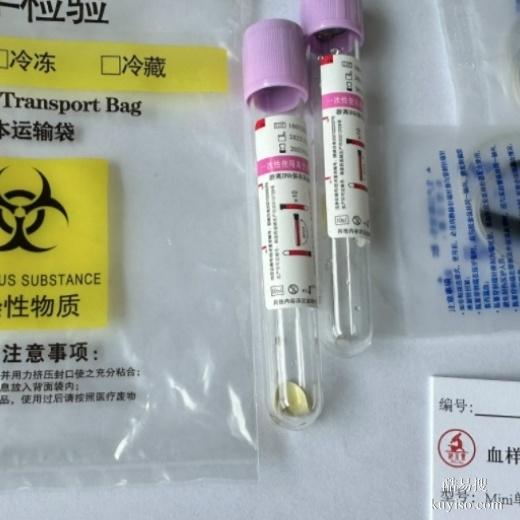 臺(tái)州懷著孕怎么做親子鑒定-2025正規(guī)鑒定機(jī)構(gòu)大全