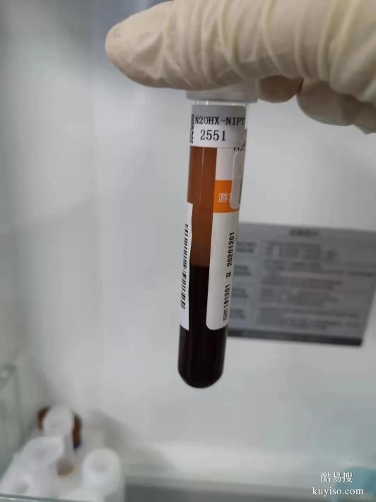 唐山牙刷親子鑒定準(zhǔn)確率高嗎？親緣存疑鑒定中心解析