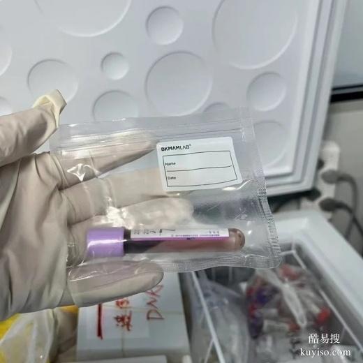 臺(tái)州親子鑒定機(jī)構(gòu)會(huì)不會(huì)作假-2025市區(qū)司法鑒定所