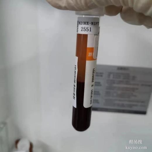 臺(tái)州親子鑒定不被發(fā)現(xiàn)正常嗎-2025更新孕期鑒定機(jī)構(gòu)